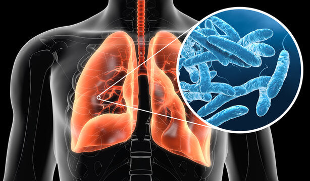 H2O Enterprise legionella bacterie